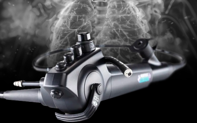 Broncoscopio es sinónimo de exactitud